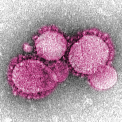 coronavirus 2019-nCoV